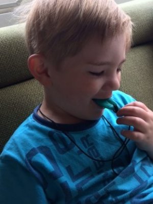 review bijtketting drop